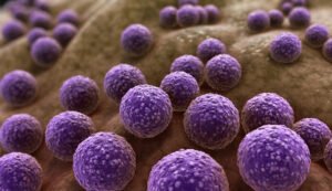 Read more about the article Antimicrobial resistance to cause 1.91 million deaths annually by 2050—Report 