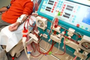 Read more about the article Nigerians with kidney ailments face high dialysis costs as transplant exceeds N14 million 