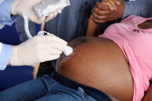 Read more about the article Why more Nigerian women are opting for C-Section despite rising cost  