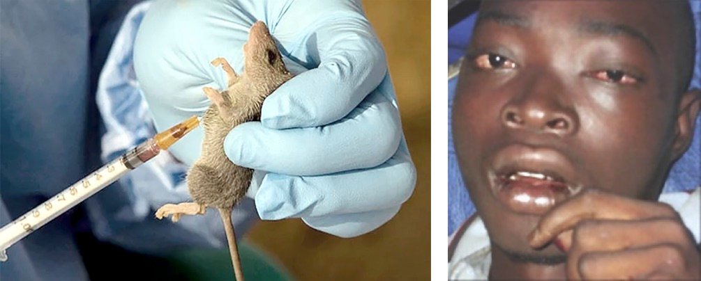 You are currently viewing Lassa fever here again!